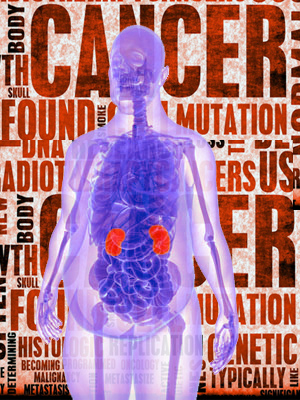 Grasas y cáncer - Quilo  de Ciencia podcast - Cienciaes.com