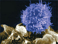Linfocitos antitumorales de diseño - Quilo de Ciencia - cienciaes.com