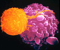 Muerte celular - Quilo de Ciencia - Cienciaes.com