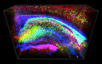 Cerebro transparente - Quilo de Ciencia podcast - Cienciaes.com