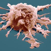 esurrección molecular y evolución. Traición en el corazón de los tumores. Quilo de Ciencia podcast - CienciaEs.com
