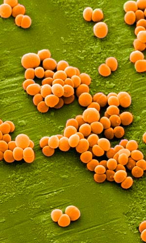 Astutas bacterias resistentes - Quilo de Ciencia - CienciaEs.com