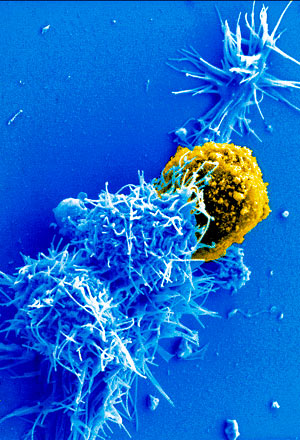 Más cerca de la inmunoterapia contra el cáncer - Quilo de Ciencia podcast - CienciaEs.com