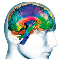 El cerebro influye en el cuerpo - Cierta Ciencia podcast - CienciaEs.com