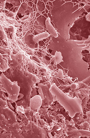 Una nueva celulosa bacteriana - Quilo de Ciencia Podcast - CienciaEs.com