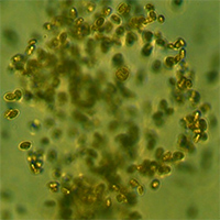 Moco bacteriano - Quilo de Ciencia podcast - Cienciaes.com