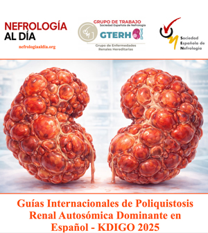Poliquistosis renal - Hablando con Científicos podcast - Cienciaes.com