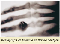 Radiografía de Bertha Röntgen